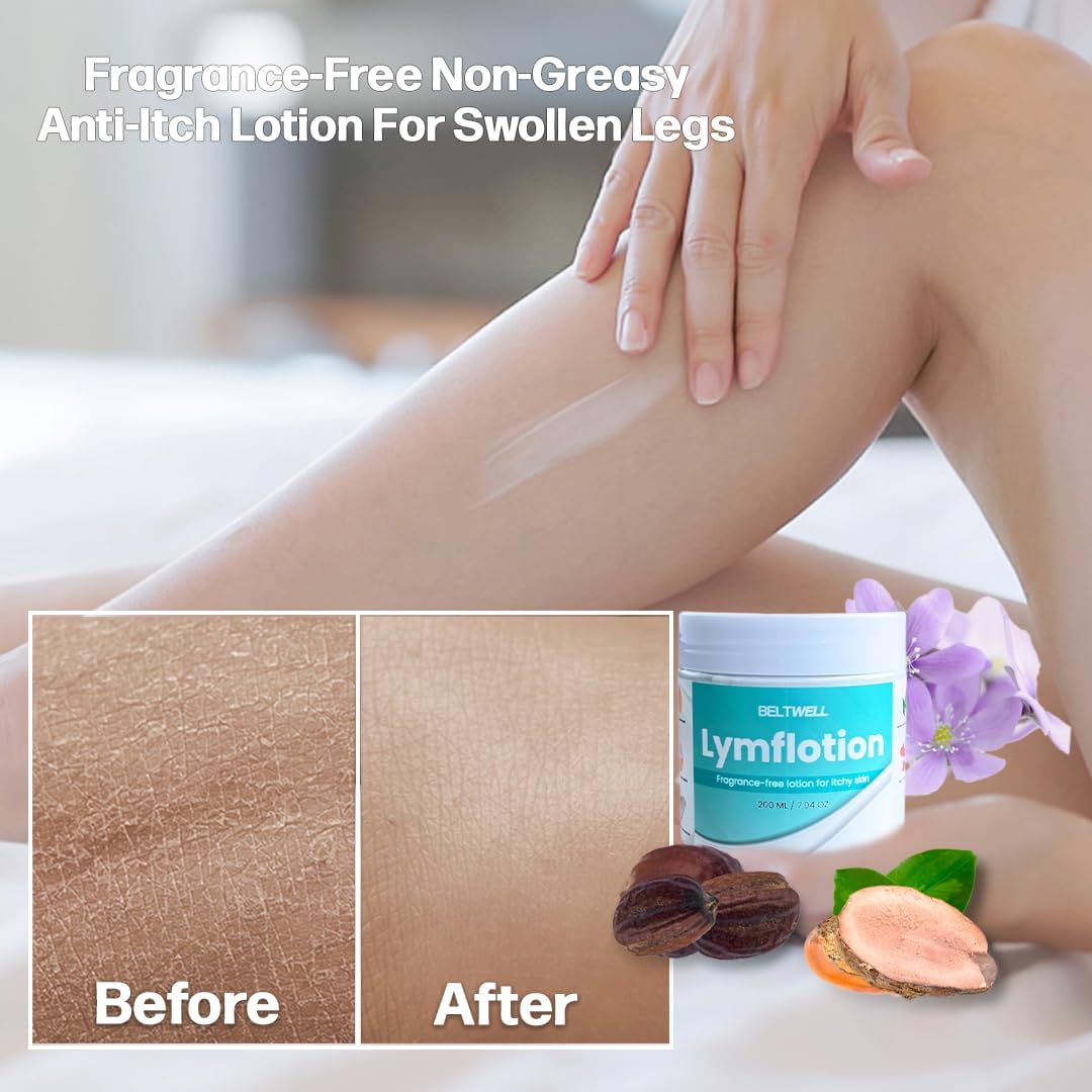 Beltwell® Fragrance-Free Anti-Itch Lotion for Swollen Legs, Dry & Sensitive Skin Relief – Non-Greasy Moisturizer for Itchy Skin, Lymphedema, Diabetes, Eczema, Cracked Feet & Arms – 200ml