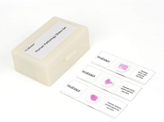 Prepared Human Pathology Microscope Slide Set, 12pcs Research-Quality Prepared Tissue Microscope Slides of Human Diseases (Human Pathology)