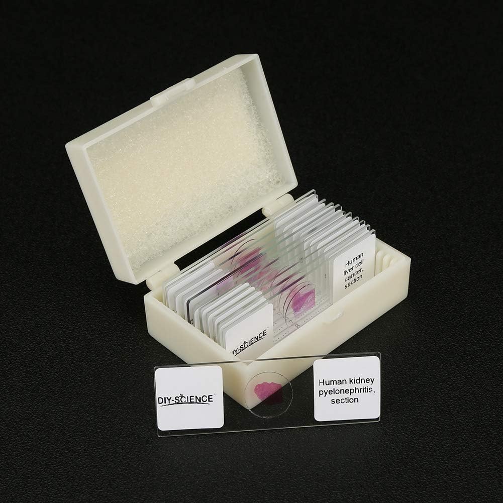 Prepared Human Pathology Microscope Slide Set, 12pcs Research-Quality Prepared Tissue Microscope Slides of Human Diseases (Human Pathology)